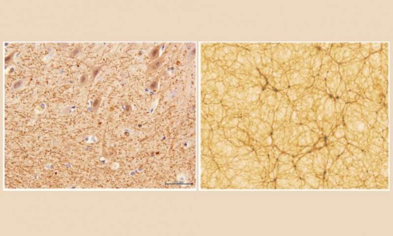 cerebellum