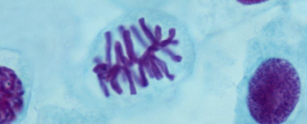 Metaphase