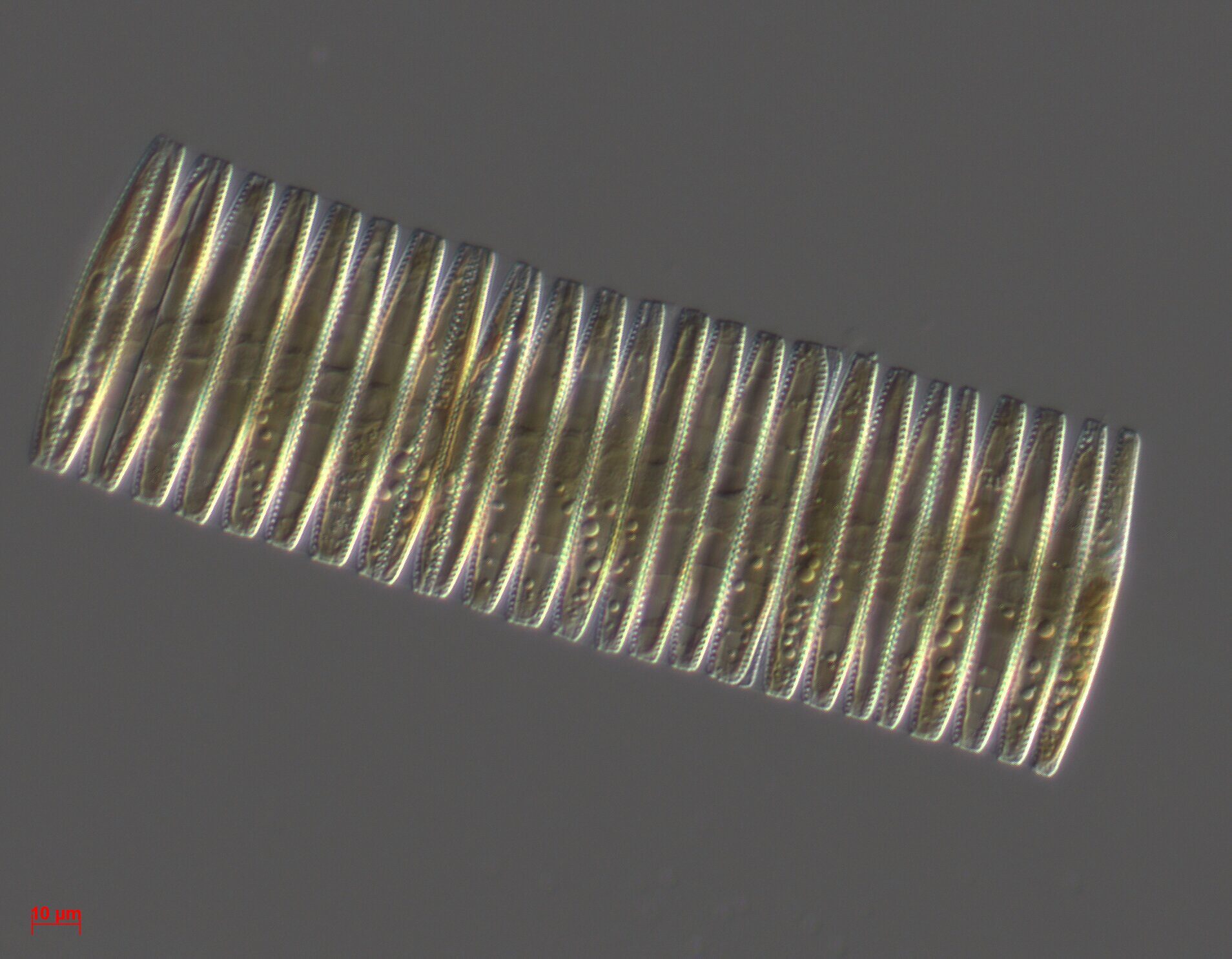 diatom