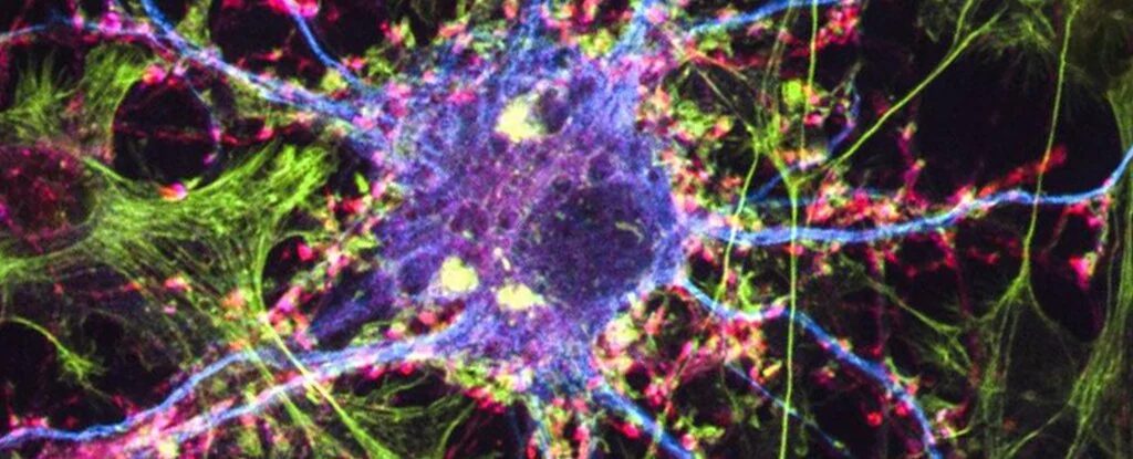 Branching nerve cells