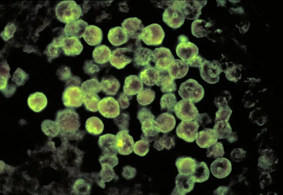 Click to enlarge Naegleria fowleri