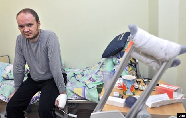 Click to enlarge Oleg Kashin russia journalist