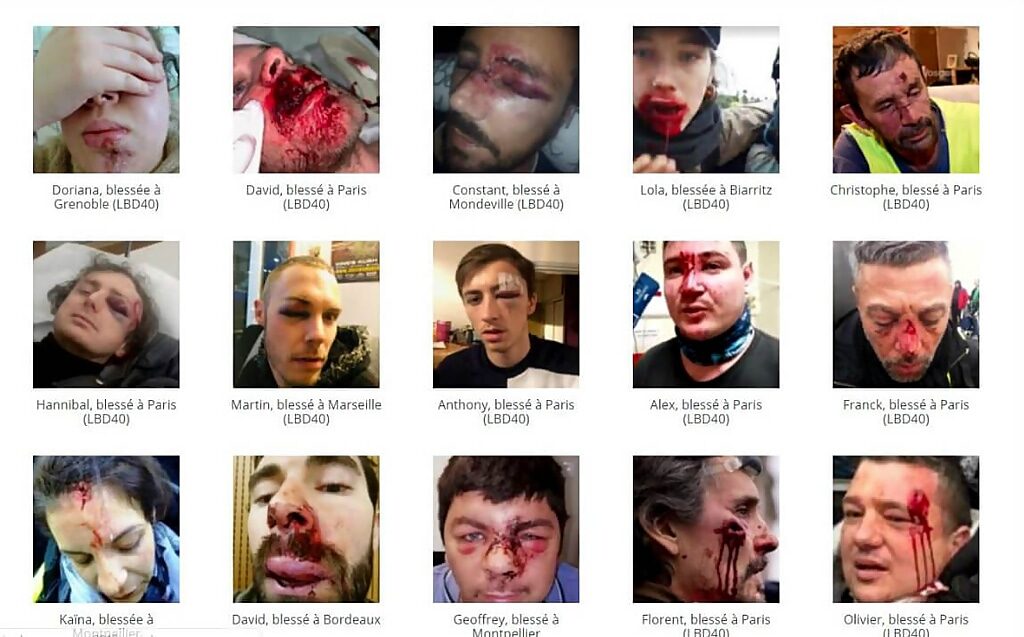 yellow vest injuries