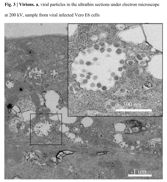 Click to enlarge coronavirus microscope