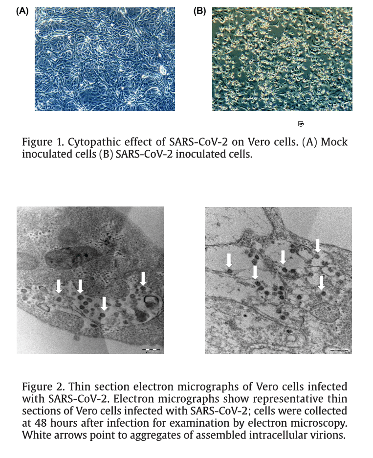 Click to enlarge electron micrographs coronavirus