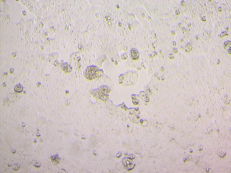 Click to enlarge sars-cov-2 microscope