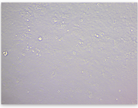 Click to enlarge sars-cov-2 microscope