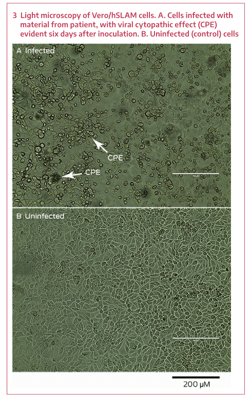 Click to enlarge sars-cov-2 microscope