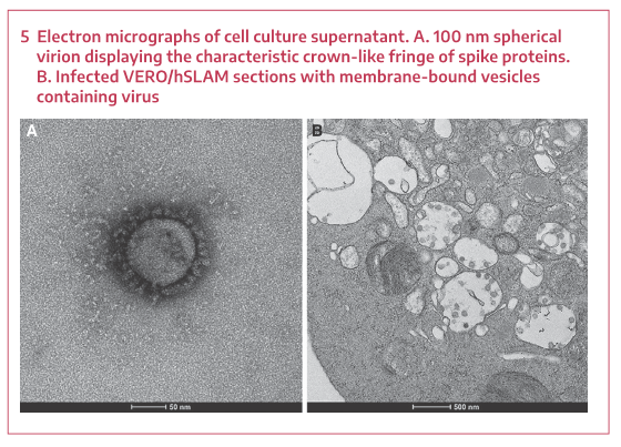 electron micrograph sars-cov-2