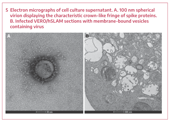 Click to enlarge electron micrograph sars-cov-2