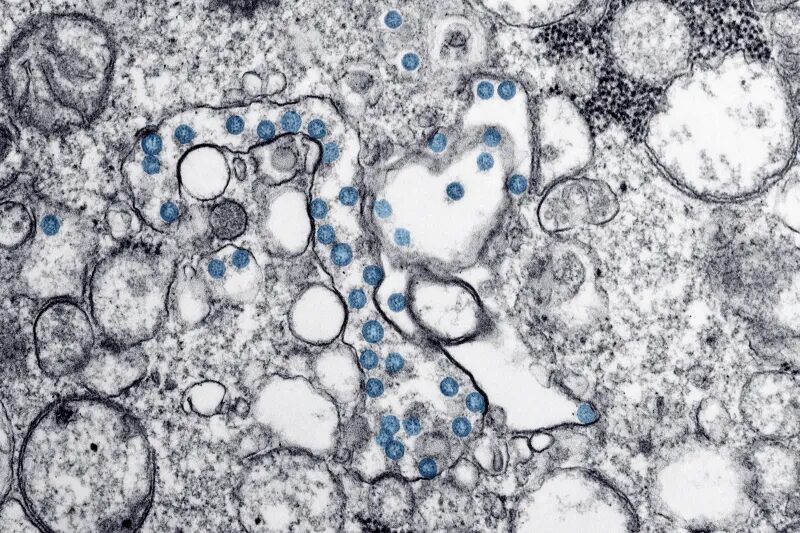 Click to enlarge sars-cov-2 photograph