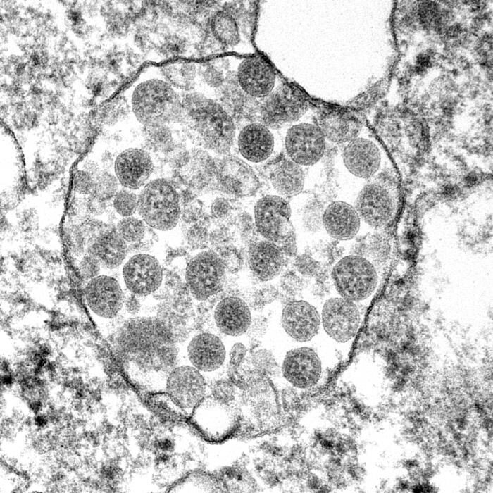 Click to enlarge sars-cov-2 photograph