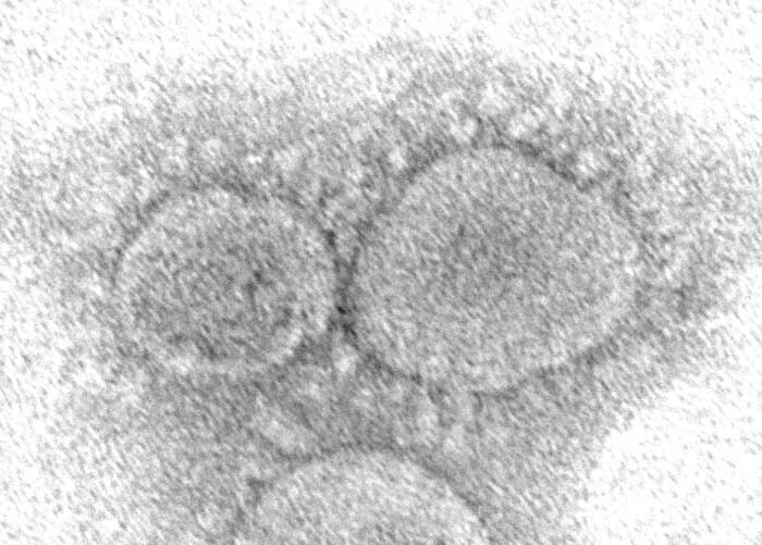 Click to enlarge sars-cov-2 photograph