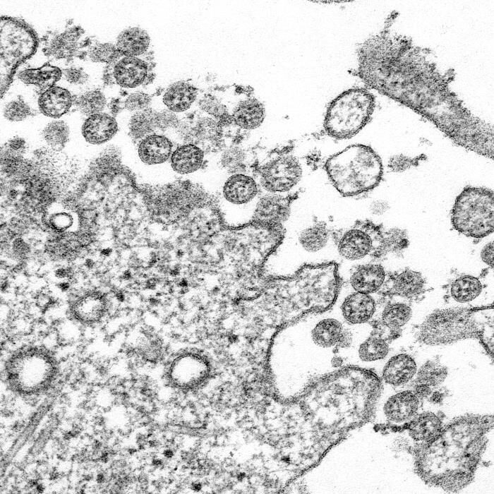 Click to enlarge sars-cov-2