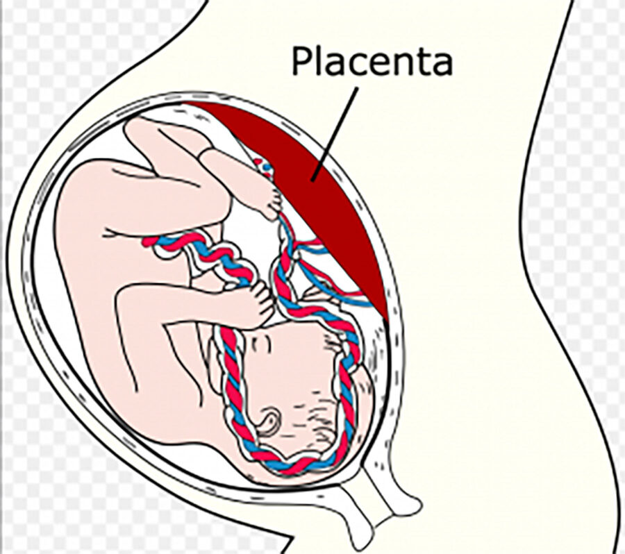 Placenata