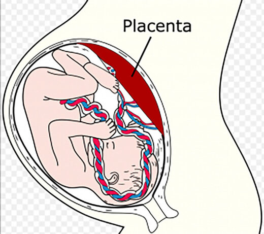 Placenata