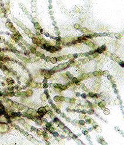 Click to enlarge Cyanobacteria