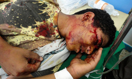 Click to enlarge wounded protester