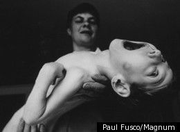 Click to enlarge Chernobyl victim