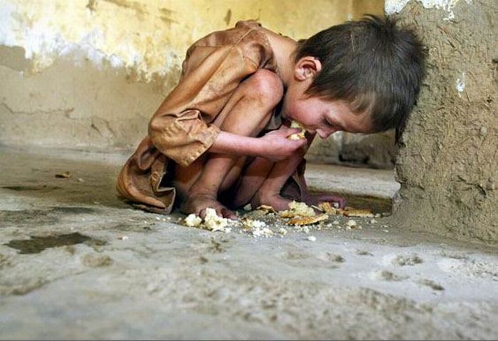 starving child