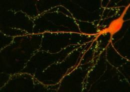 Click to enlarge brain stress neuropathway
