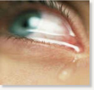 eye