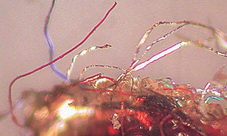 Click to enlarge Morgellons
