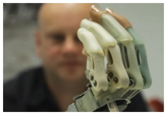 Bionic Hands