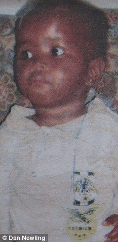 Click to enlarge Child attacked by Rat
