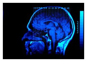 Click to enlarge X-Ray Scan