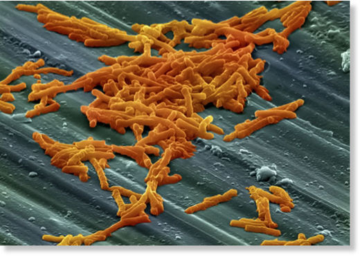 Click to enlarge C. Difficile