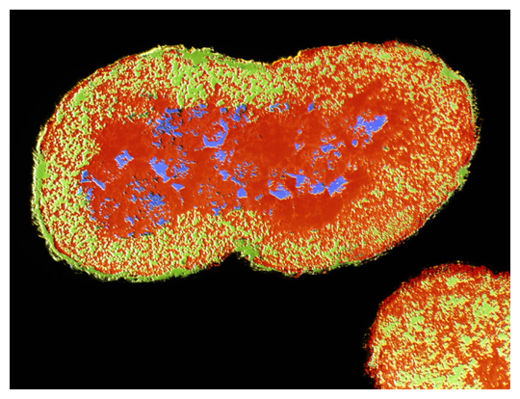 Gonorrhoea