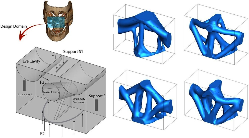 Click to enlarge Facial Reconstruction_2