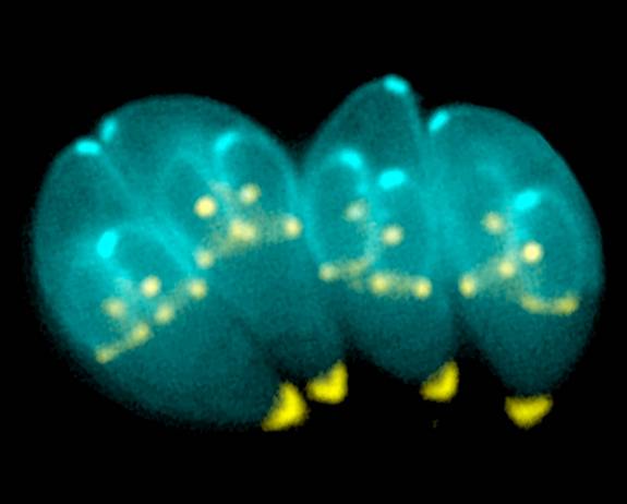 Click to enlarge Toxoplasma gondii