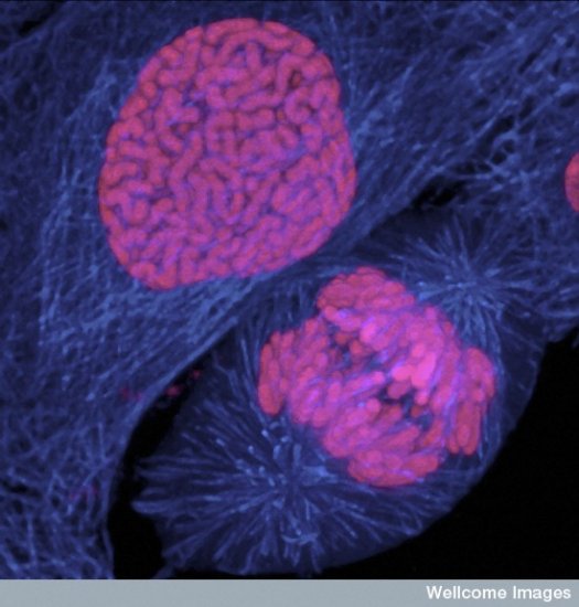 Cancer Cells