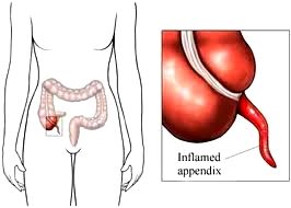 Click to enlarge appendix_01