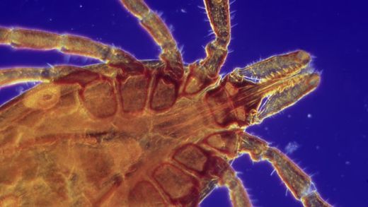 A tick is shown in this file photo.