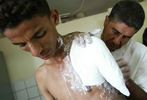 Click to enlarge Cluster bomb victim