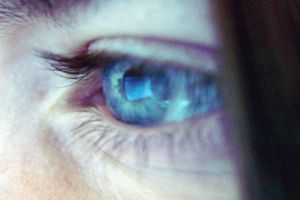 eye surveillence