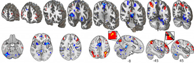Click to enlarge fMRI Scans