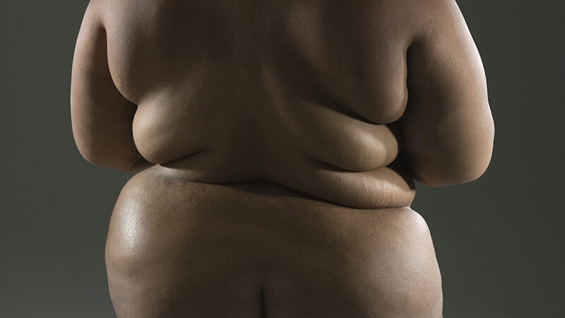 Health experts: Obesity fuelling vastly higher COVID death toll -- Sott.net...
