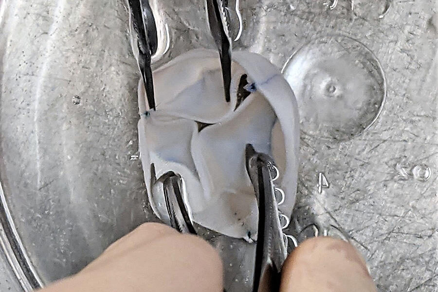 Click to enlarge Heart Valve