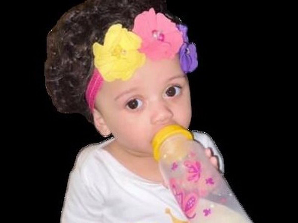 The baby girl was bitten on the head by her dog