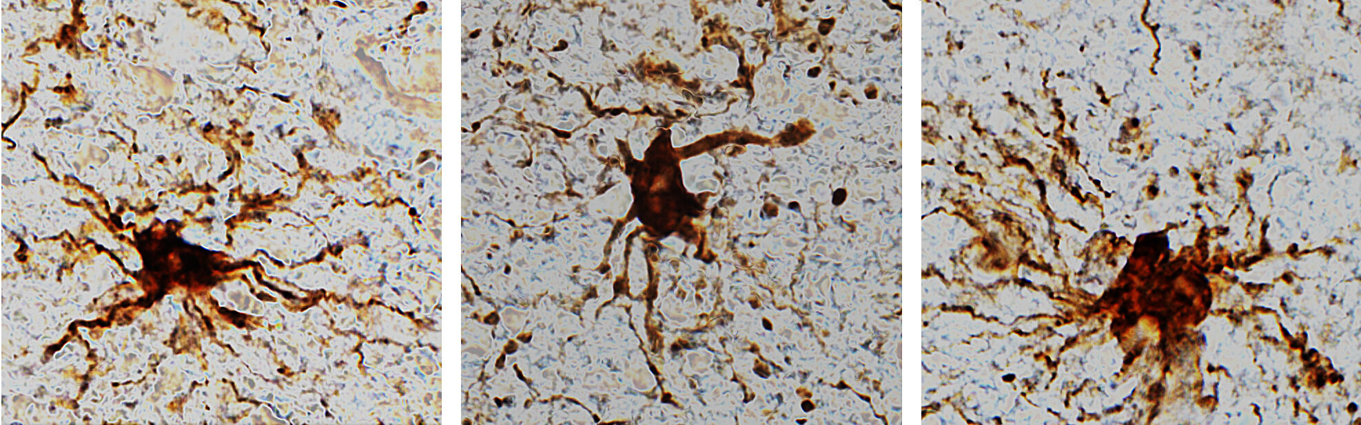 Zombie Cells