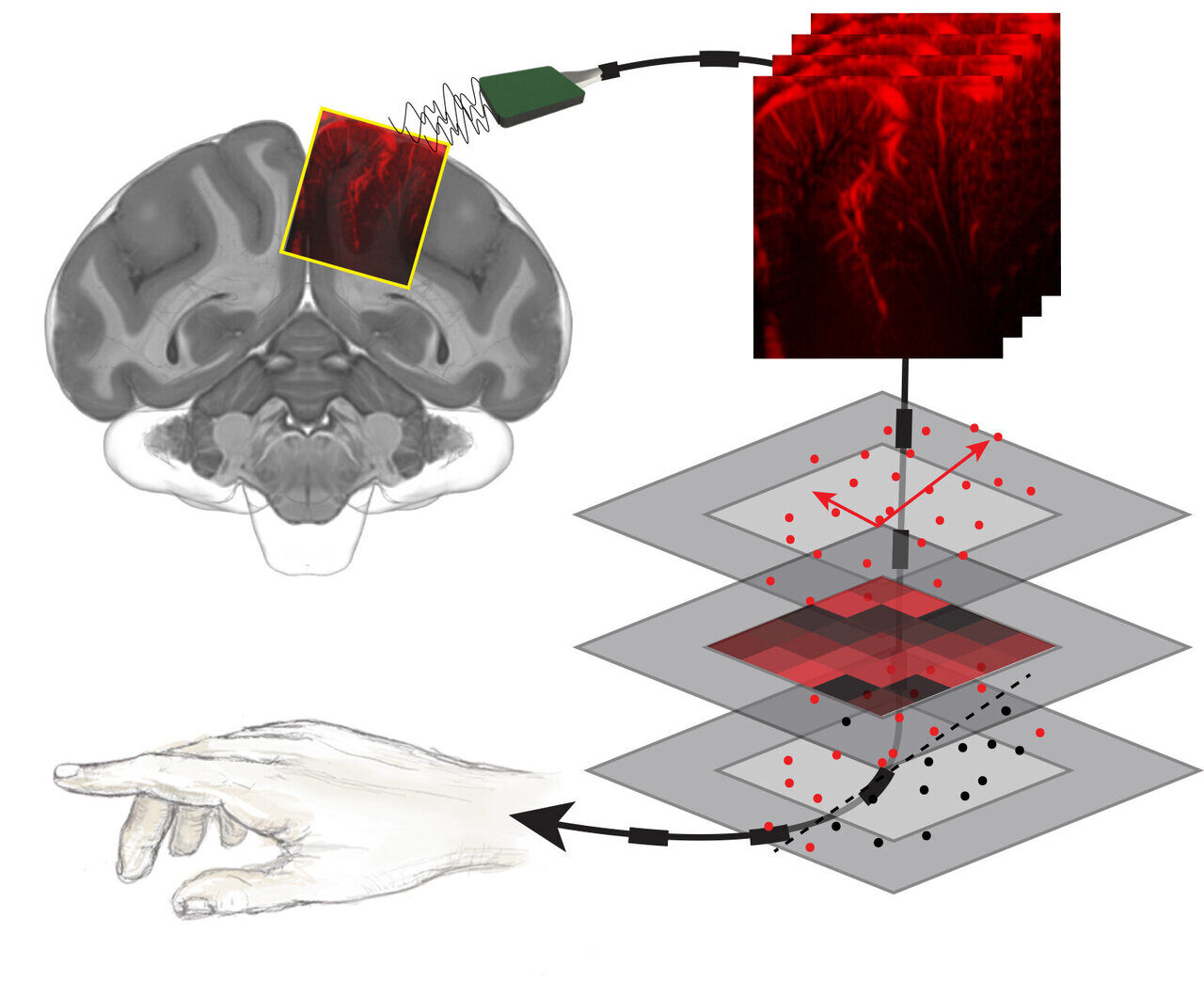 Click to enlarge Ultrasound Mind Reading
