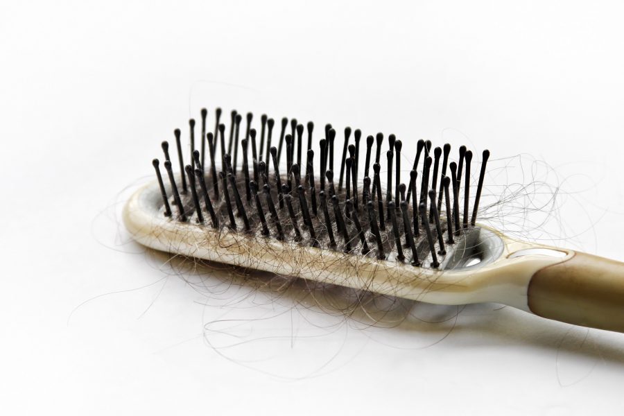 Click to enlarge Hair Loss