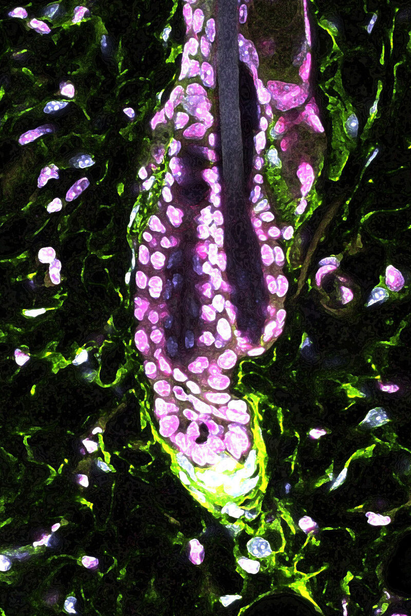 Click to enlarge Mouse Hair Follicle