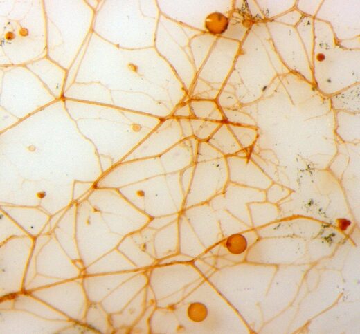 Click to enlarge hyphae