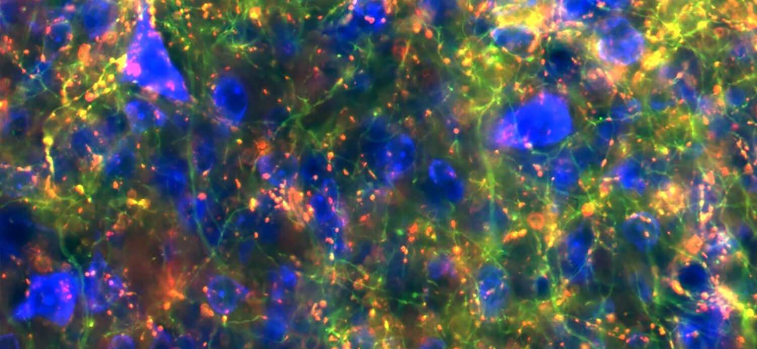 Brain Axons