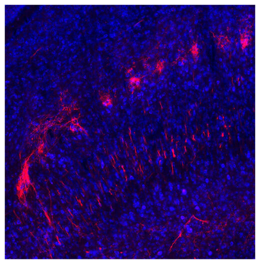 Click to enlarge Axons in Brain Region